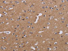 The image on the left is immunohistochemistry of paraffin-embedded Human brain tissue using CSB-PA271484 (NDUFA1 Antibody) at dilution 1/30, on the right is treated with fusion protein. (Original magnification: ×200)