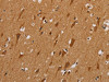 The image is immunohistochemistry of paraffin-embedded Human brain tissue using CSB-PA226934 (NDUFAF1 Antibody) at dilution 1/25. (Original magnification: ×200)