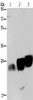 Gel: 10%SDS-PAGE, Lysate: 40 μg, Lane 1-3: Jurkat cells, mouse heart tissue, Mouse brain tissue, Primary antibody: CSB-PA193298 (NDUFS8 Antibody) at dilution 1/250, Secondary antibody: Goat anti rabbit IgG at 1/8000 dilution, Exposure time: 20 seconds