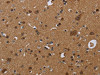 The image on the left is immunohistochemistry of paraffin-embedded Human brain tissue using CSB-PA067561 (NDUFS8 Antibody) at dilution 1/50, on the right is treated with fusion protein. (Original magnification: ×200)