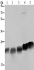 Gel: 10%SDS-PAGE, Lysate: 40 μg, Lane 1-5: K562 cells, Hela cells, Jurkat cells, mouse heart tissue, Mouse spleen tissue, Primary antibody: CSB-PA067561 (NDUFS8 Antibody) at dilution 1/250, Secondary antibody: Goat anti rabbit IgG at 1/8000 dilution, Exposure time: 5 seconds