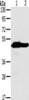Gel: 8%SDS-PAGE, Lysate: 40 μg, Lane 1-2: Mouse heart tissue, Mouse brain tissue, Primary antibody: CSB-PA914526 (NDUFV1 Antibody) at dilution 1/500, Secondary antibody: Goat anti rabbit IgG at 1/8000 dilution, Exposure time: 30 seconds