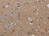 The image on the left is immunohistochemistry of paraffin-embedded Human brain tissue using CSB-PA520187 (PVRL3 Antibody) at dilution 1/40, on the right is treated with fusion protein. (Original magnification: ×200)