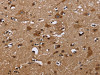 The image on the left is immunohistochemistry of paraffin-embedded Human brain tissue using CSB-PA229917 (NCSTN Antibody) at dilution 1/50, on the right is treated with fusion protein. (Original magnification: ×200)