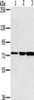 Gel: 6%SDS-PAGE, Lysate: 40 μg, Lane 1-3: Human testis tissue, Jurkat cells, mouse liver tissue, Primary antibody: CSB-PA995714 (KIRREL2 Antibody) at dilution 1/500, Secondary antibody: Goat anti rabbit IgG at 1/8000 dilution, Exposure time: 15 seconds