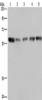 Gel: 8%SDS-PAGE, Lysate: 40 μg, Lane 1-5: Hela cells, human brain malignant glioma tissue, NIH/3T3 cells, PC3 cells, A549 cells, Primary antibody: CSB-PA255769 (NUP62 Antibody) at dilution 1/300, Secondary antibody: Goat anti rabbit IgG at 1/8000 dilution, Exposure time: 5 seconds