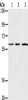 Gel: 6%SDS-PAGE, Lysate: 40 μg, Lane 1-3: Human breast infiltrative duct tissue, Jurkat cells, HT29 cells, Primary antibody: CSB-PA220770 (OXSR1 Antibody) at dilution 1/300, Secondary antibody: Goat anti rabbit IgG at 1/8000 dilution, Exposure time: 10 seconds
