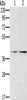 Gel: 8%SDS-PAGE, Lysate: 40 μg, Lane 1-2: Hela cells, lovo cells, Primary antibody: CSB-PA785521 (PDGFRL Antibody) at dilution 1/400, Secondary antibody: Goat anti rabbit IgG at 1/8000 dilution, Exposure time: 10 minutes