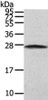 Gel: 12%SDS-PAGE, Lysate: 40 μg, Lane: NIH/3T3 cell, Primary antibody: CSB-PA986206 (PGRMC2 Antibody) at dilution 1/200 dilution, Secondary antibody: Goat anti rabbit IgG at 1/8000 dilution, Exposure time: 5 seconds