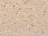 The image on the left is immunohistochemistry of paraffin-embedded Human brain tissue using CSB-PA964444 (PHLPP1 Antibody) at dilution 1/35, on the right is treated with fusion protein. (Original magnification: ×200) The image on the left is immunohistochemistry of paraffin-embedded Human brain tissue using CSB-PA964444 (PHLPP1 Antibody) at dilution 1/35, on the right is treated with fusion protein. (Original magnification: ×200)