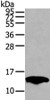 Gel: 12%SDS-PAGE, Lysate: 40 μg, Lane: Mouse fat tissue, Primary antibody: CSB-PA295677 (PMP2 Antibody) at dilution 1/400 dilution, Secondary antibody: Goat anti rabbit IgG at 1/8000 dilution, Exposure time: 15 seconds