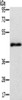 Gel: 8%SDS-PAGE, Lysate: 40 μg, Lane: Lovo cells, Primary antibody: CSB-PA278516 (TWF1 Antibody) at dilution 1/400, Secondary antibody: Goat anti rabbit IgG at 1/8000 dilution, Exposure time: 2 minutes Gel: 8%SDS-PAGE, Lysate: 40 μg, Lane: Lovo cells, Primary antibody: CSB-PA278516 (TWF1 Antibody) at dilution 1/400, Secondary antibody: Goat anti rabbit IgG at 1/8000 dilution, Exposure time: 2 minutes