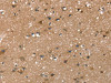 The image on the left is immunohistochemistry of paraffin-embedded Human brain tissue using CSB-PA994941 (RAB9A Antibody) at dilution 1/25, on the right is treated with fusion protein. (Original magnification: ×200)