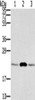 Gel: 12%SDS-PAGE, Lysate: 40 μg, Lane 1-3: RAW264.7, hepg2 cells, hela cells, Primary antibody: CSB-PA994941 (RAB9A Antibody) at dilution 1/300, Secondary antibody: Goat anti rabbit IgG at 1/8000 dilution, Exposure time: 30 seconds