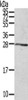 Gel: 12%SDS-PAGE, Lysate: 40 μg, , Primary antibody: CSB-PA900548 (RAB20 Antibody) at dilution 1/200 dilution, Secondary antibody: Goat anti rabbit IgG at 1/8000 dilution, Exposure time: 40 seconds