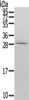 Gel: 12%SDS-PAGE, Lysate: 40 μg, , Primary antibody: CSB-PA173917 (RAB20 Antibody) at dilution 1/200 dilution, Secondary antibody: Goat anti rabbit IgG at 1/8000 dilution, Exposure time: 30 seconds Gel: 12%SDS-PAGE, Lysate: 40 μg, , Primary antibody: CSB-PA173917 (RAB20 Antibody) at dilution 1/200 dilution, Secondary antibody: Goat anti rabbit IgG at 1/8000 dilution, Exposure time: 30 seconds