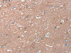 The image on the left is immunohistochemistry of paraffin-embedded Human brain tissue using CSB-PA077173 (RHEB Antibody) at dilution 1/20, on the right is treated with fusion protein. (Original magnification: ×200)