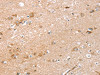 The image on the left is immunohistochemistry of paraffin-embedded Human brain tissue using CSB-PA925916 (RNASET2 Antibody) at dilution 1/30, on the right is treated with fusion protein. (Original magnification: ×200)