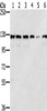 Gel: 6%SDS-PAGE, Lysate: 40 μg, Lane 1-6: Lovo cells, A172 cells, A375 cells, 231 cells, Jurkat cells, hela cells, Primary antibody: CSB-PA870281 (RNF20 Antibody) at dilution 1/350, Secondary antibody: Goat anti rabbit IgG at 1/8000 dilution, Exposure time: 5 seconds