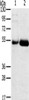 Gel: 8%SDS-PAGE, Lysate: 40 μg, Lane 1-2: Human placenta tissue, Human stomach cancer tissue, Primary antibody: CSB-PA930566 (SAMD3 Antibody) at dilution 1/400, Secondary antibody: Goat anti rabbit IgG at 1/8000 dilution, Exposure time: 4 minutes