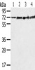 Gel: 8%SDS-PAGE, Lysate: 40 μg, Lane 1-4: Mouse brain tissue, Hela cells, Jurkat cells, Mouse heart tissue, Primary antibody: CSB-PA107310 (SDHA Antibody) at dilution 1/600 dilution, Secondary antibody: Goat anti rabbit IgG at 1/8000 dilution, Exposure time: 5 seconds