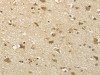 The image on the left is immunohistochemistry of paraffin-embedded Human brain tissue using CSB-PA679493 (SEMA4F Antibody) at dilution 1/35, on the right is treated with fusion protein. (Original magnification: ×200)
