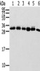 Gel: 12%SDS-PAGE, Lysate: 40 μg, Lane 1-6: 293T cells, Hela cells, Lovo cells, Raji cells, HUEVC cells, Mouse spleen tissue, Primary antibody: CSB-PA951733 (SENP8 Antibody) at dilution 1/600 dilution, Secondary antibody: Goat anti rabbit IgG at 1/8000 dilution, Exposure time: 20 seconds