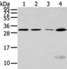 Gel: 12%SDS-PAGE, Lysate: 40 μg, Lane 1-4: Hela, Jurkat and hepg2 cell, human fetal liver tissue, Primary antibody: CSB-PA490759 (SIAH1 Antibody) at dilution 1/300 dilution, Secondary antibody: Goat anti rabbit IgG at 1/8000 dilution, Exposure time: 1 minute