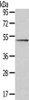 Gel: 8%SDS-PAGE, Lysate: 40 μg, , Primary antibody: CSB-PA080227 (SRP54 Antibody) at dilution 1/500 dilution, Secondary antibody: Goat anti rabbit IgG at 1/8000 dilution, Exposure time: 2 minutes