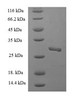 (Tris-Glycine gel) Discontinuous SDS-PAGE (reduced) with 5% enrichment gel and 15% separation gel.