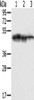 Gel: 8%SDS-PAGE, Lysate: 40 μg, Lane 1-3: Hepg2 cells, K562 cells, Jurkat cells, Primary antibody: CSB-PA062373 (SMARCB1 Antibody) at dilution 1/400, Secondary antibody: Goat anti rabbit IgG at 1/8000 dilution, Exposure time: 10 seconds