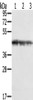 Gel: 8%SDS-PAGE, Lysate: 40 μg, Lane 1-3: Jurkat cells, K562 cells, hepg2 cells, Primary antibody: CSB-PA014989 (SMARCB1 Antibody) at dilution 1/450, Secondary antibody: Goat anti rabbit IgG at 1/8000 dilution, Exposure time: 10 seconds