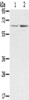 Gel: 8%SDS-PAGE, Lysate: 40 μg, Lane 1-2: A375 cells, hela cells, Primary antibody: CSB-PA088228 (STXBP1 Antibody) at dilution 1/300, Secondary antibody: Goat anti rabbit IgG at 1/8000 dilution, Exposure time: 20 seconds