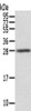 Gel: 12%SDS-PAGE, Lysate: 40 μg, , Primary antibody: CSB-PA299879 (STX8 Antibody) at dilution 1/500 dilution, Secondary antibody: Goat anti rabbit IgG at 1/8000 dilution, Exposure time: 5seconds