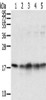 Gel: 12%SDS-PAGE, Lysate: 40 μg, Lane 1-5: Mouse brain tissue, Mouse heart tissue, Jurkat cells, K562 cells, hela cells, Primary antibody: CSB-PA210339 (TAF11 Antibody) at dilution 1/800, Secondary antibody: Goat anti rabbit IgG at 1/8000 dilution, Exposure time: 20 seconds