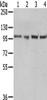 Gel: 6%SDS-PAGE, Lysate: 40 μg, Lane 1-4: A431 cells, 293T cells, Hela cells, K562 cells, Primary antibody: CSB-PA251071 (TPX2 Antibody) at dilution 1/800 dilution, Secondary antibody: Goat anti rabbit IgG at 1/8000 dilution, Exposure time: 10 seconds