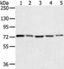 Gel: 6%SDS-PAGE, Lysate: 40 μg, Lane 1-5: Hela, lncap, skov3, 293T and TM4 cell, Primary antibody: CSB-PA038312 (TGM4 Antibody) at dilution 1/400 dilution, Secondary antibody: Goat anti rabbit IgG at 1/8000 dilution, Exposure time: 10 seconds