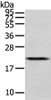 Gel: 12%SDS-PAGE, Lysate: 40 μg, Lane: Human placenta tissue, Primary antibody: CSB-PA922141 (MED28 Antibody) at dilution 1/400 dilution, Secondary antibody: Goat anti rabbit IgG at 1/8000 dilution, Exposure time: 30 seconds Gel: 12%SDS-PAGE, Lysate: 40 μg, Lane: Human placenta tissue, Primary antibody: CSB-PA922141 (MED28 Antibody) at dilution 1/400 dilution, Secondary antibody: Goat anti rabbit IgG at 1/8000 dilution, Exposure time: 30 seconds