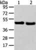 Gel: 8%SDS-PAGE, Lysate: 40 μg, Lane 1-2: 231 cell and human fetal liver tissue, Primary antibody: CSB-PA172809 (TRIB2 Antibody) at dilution 1/450 dilution, Secondary antibody: Goat anti rabbit IgG at 1/8000 dilution, Exposure time: 1 minute