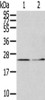 Gel: 12%SDS-PAGE, Lysate: 40 μg, Lane 1-2: Hela cells, Human fetal liver tissue, Primary antibody: CSB-PA274847 (ITPA Antibody) at dilution 1/400 dilution, Secondary antibody: Goat anti rabbit IgG at 1/8000 dilution, Exposure time: 5 minutes