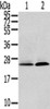 Gel: 12%SDS-PAGE, Lysate: 40 μg, Lane 1-2: Human fetal liver tissue, Hela cells, Primary antibody: CSB-PA910876 (ITPA Antibody) at dilution 1/200 dilution, Secondary antibody: Goat anti rabbit IgG at 1/8000 dilution, Exposure time: 2 minutes