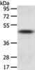 Gel: 8%SDS-PAGE, Lysate: 40 μg, Lane: Mouse adrenal gland tissue, Primary antibody: CSB-PA091574 (TTC23 Antibody) at dilution 1/800 dilution, Secondary antibody: Goat anti rabbit IgG at 1/8000 dilution, Exposure time: 10 seconds