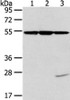 Gel: 8%SDS-PAGE, Lysate: 40 μg, Lane 1-3: Hela, K562 and NIH/3T3 cell, Primary antibody: CSB-PA067976 (TUBA1C Antibody) at dilution 1/400 dilution, Secondary antibody: Goat anti rabbit IgG at 1/8000 dilution, Exposure time: 10 seconds