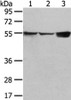 Gel: 6%SDS-PAGE, Lysate: 40 μg, Lane 1-3: 231 and hela cell, mouse liver tissue, Primary antibody: CSB-PA451449 (UGT1A10 Antibody) at dilution 1/300 dilution, Secondary antibody: Goat anti rabbit IgG at 1/8000 dilution, Exposure time: 10 seconds