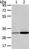 Gel: 8%SDS-PAGE, Lysate: 40 μg, Lane 1-2: Human fetal brain tissue and hela cell, Primary antibody: CSB-PA441389 (SDCBP Antibody) at dilution 1/450 dilution, Secondary antibody: Goat anti rabbit IgG at 1/8000 dilution, Exposure time: 3 seconds