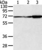 Gel: 8%SDS-PAGE, Lysate: 40 μg, Lane 1-3: A431, hepg2 and lncap cell, Primary antibody: CSB-PA084734 (DLAT Antibody) at dilution 1/800 dilution, Secondary antibody: Goat anti rabbit IgG at 1/8000 dilution, Exposure time: 3 seconds