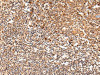The image on the left is immunohistochemistry of paraffin-embedded Human tonsil tissue using CSB-PA187364 (SWAP70 Antibody) at dilution 1/20, on the right is treated with fusion protein. (Original magnification: ×200)