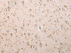 The image on the left is immunohistochemistry of paraffin-embedded Human brain tissue using CSB-PA569709 (UQCRC2 Antibody) at dilution 1/25, on the right is treated with fusion protein. (Original magnification: ×200)