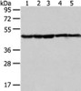 Gel: 8%SDS-PAGE, Lysate: 40 μg, Lane 1-5: Jurkat, Raji, hepg2, A431 and HT-29 cell, Primary antibody: CSB-PA569709 (UQCRC2 Antibody) at dilution 1/400 dilution, Secondary antibody: Goat anti rabbit IgG at 1/8000 dilution, Exposure time: 10 seconds