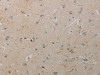 The image on the left is immunohistochemistry of paraffin-embedded Human brain tissue using CSB-PA698191 (AATK Antibody) at dilution 1/10, on the right is treated with synthetic peptide. (Original magnification: ×200)